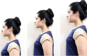 Height Increase Treatment