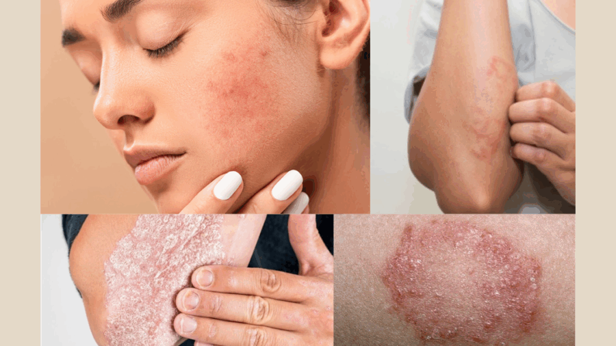 Ayurvedic Treatment for Skin Problems